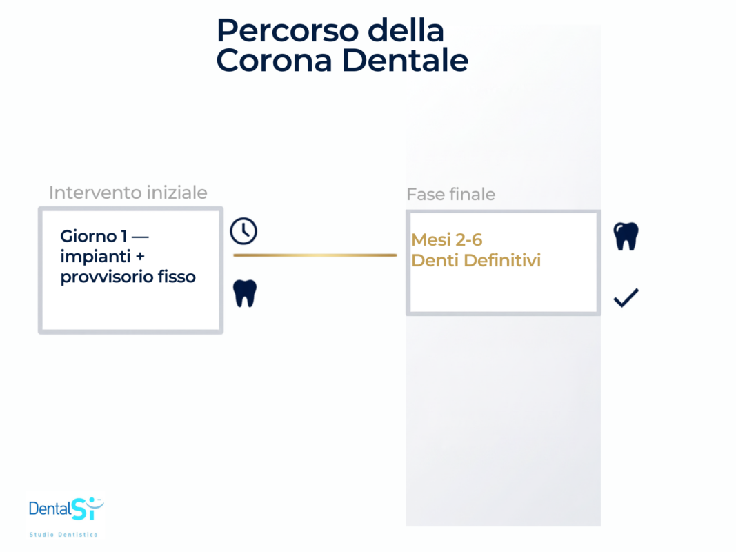 carico immediato impianto dentale denti fissi 24 ore condizioni